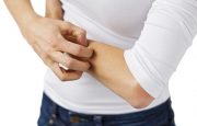 Asthma and Eczema